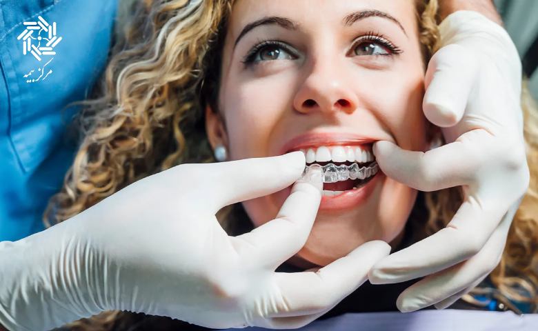 بیمه تکمیلی ارتودنسی قبول میکنه